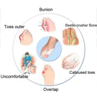 Bunion Corrector Silicone Toe Sleeves and Separator
